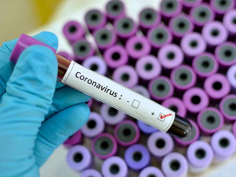 Coronavirus800x600